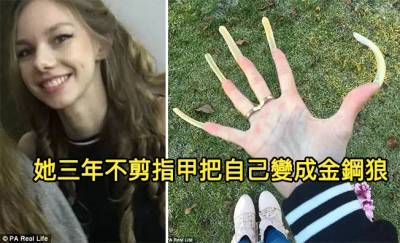 德國女孩「三年不剪指甲把自己變成金鋼狼」滿手魔爪！因為指甲太長連「體育課都不能參加」還沾沾自喜...